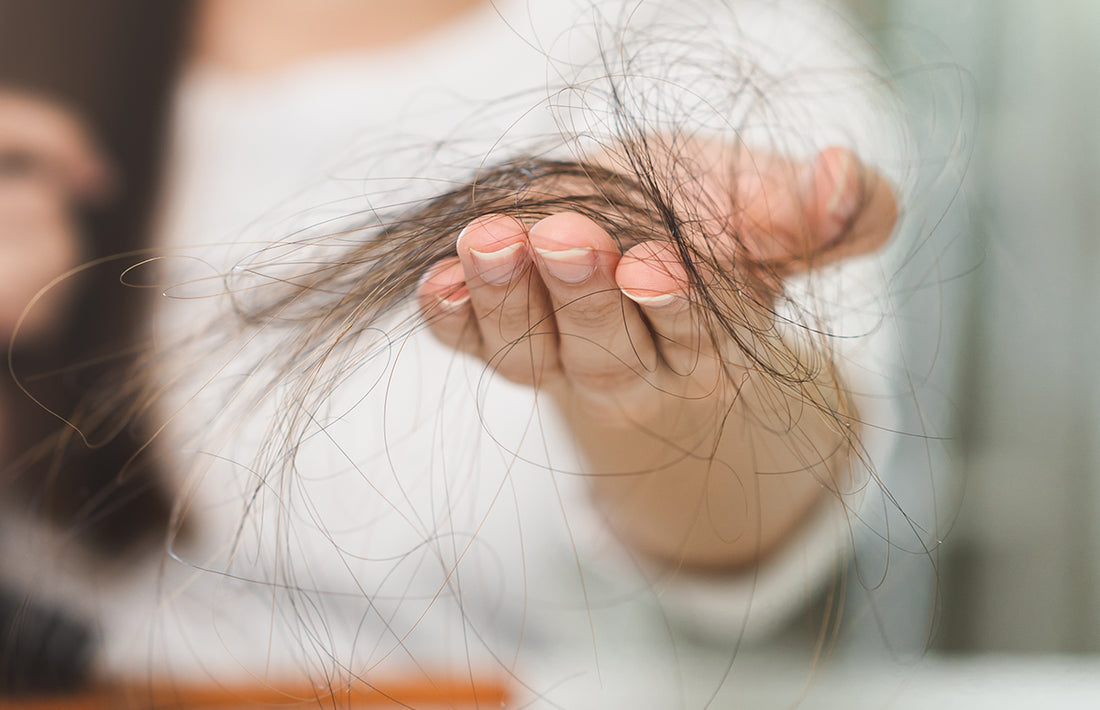 En person som håller i massa hår som har fallit från huvudet
