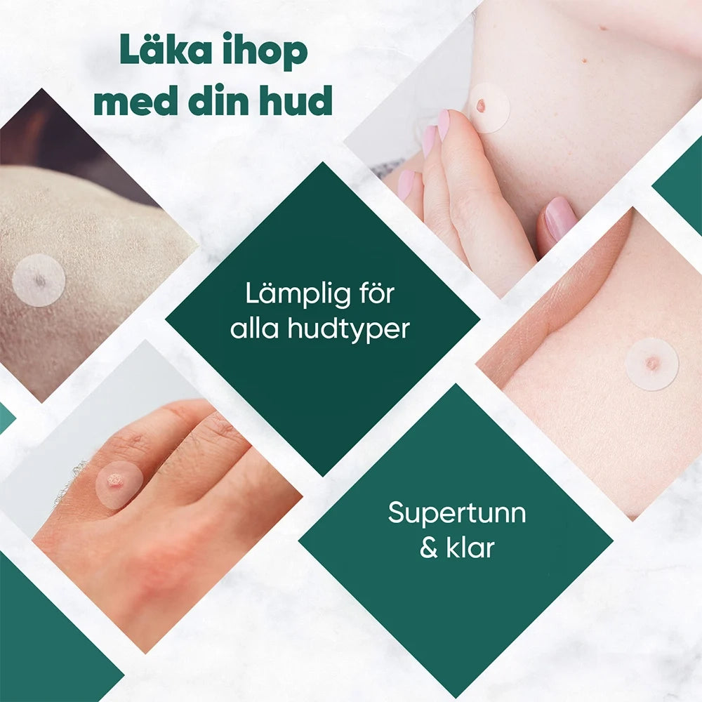 wart-corn-and-verruca-patch-se-4